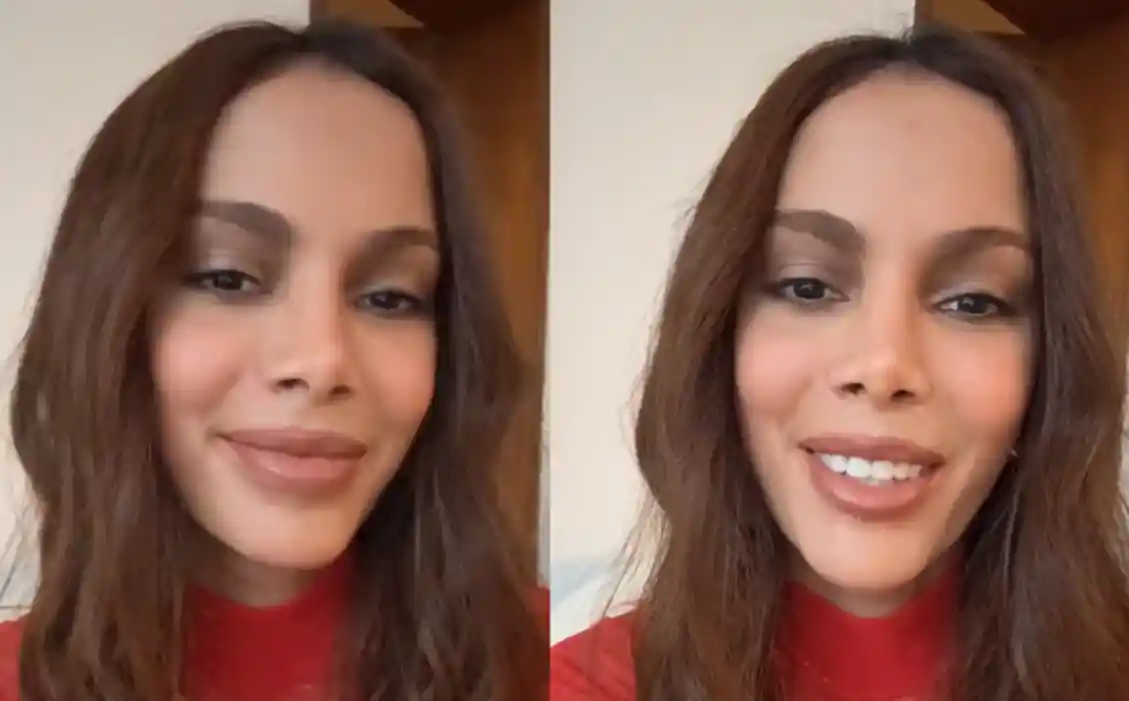 Imagem de Anitta aproveita engajamento de cirurgia plástica e reaparece para alertar sobre PLS