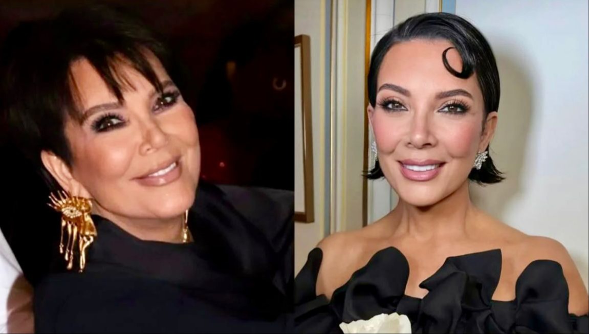 Imagem de Cirurgião plástico baiano explica o efeito Kris Jenner - que rejuvenesce 20 anos em 10 dias